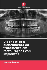Diagnóstico e planeamento do tratamento em restaurações com implantes