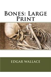 Bones