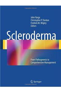 Scleroderma