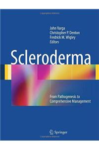 Scleroderma: From Pathogenesis to Comprehensive Management