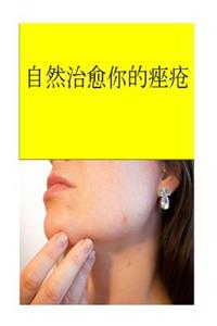 Cure Your Acne Naturally (Chinese)