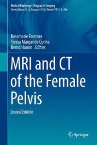 MRI and CT of the Female Pelvis