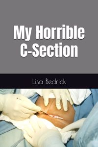 My Horrible C-Section