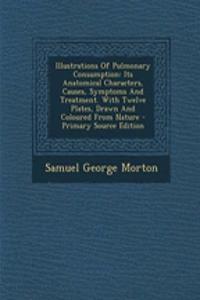 Illustrations of Pulmonary Consumption