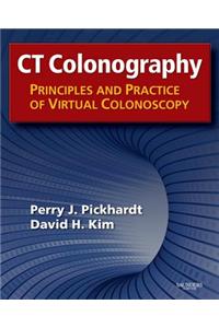 CT Colonography: Principles and Practice of Virtual Colonoscopy