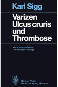 Varizen, Ulcus Cruris Und Thrombose