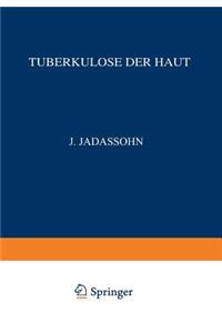 Tuberkulose Der Haut