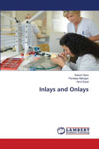 Inlays and Onlays