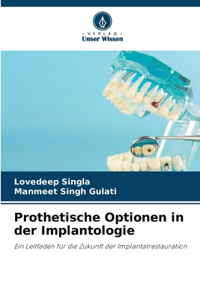 Prothetische Optionen in der Implantologie