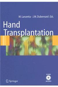 Hand transplantation