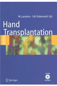 Hand transplantation