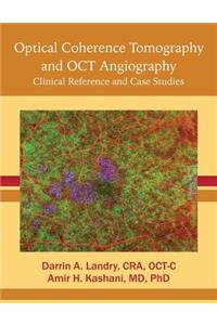 Optical Coherence Tomography and OCT Angiography