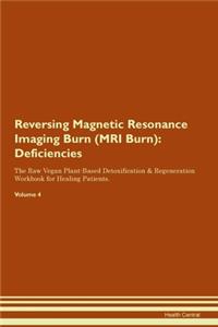 Reversing Magnetic Resonance Imaging Burn (MRI Burn)