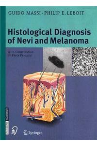The Histological Diagnosis of Nevi and Melanoma