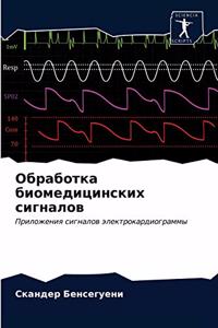 Обработка биомедицинских сигналов