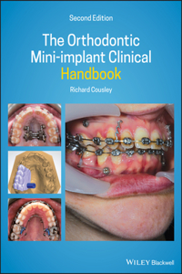 Orthodontic Mini-Implant Clinical Handbook