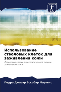 Использование стволовых клеток для зажив