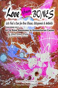 Loves Them Bones Lets Find a Cure for Bone Disease, Osteoporosis & Arthritis CHALLENGE 2017