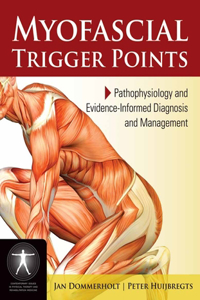 Myofascial Trigger Points: Pathophysiology and Evidence-Informed Diagnosis and Management