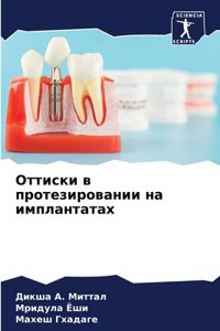 Оттиски в протезировании на имплантатах