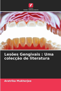 Lesões Gengivais