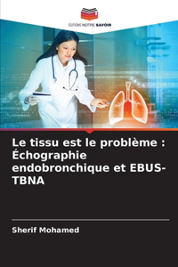 Le tissu est le problème