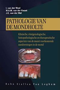 Pathologie Van de Mondholte