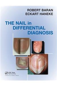 Nail in Differential Diagnosis