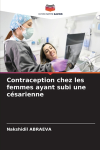 Contraception chez les femmes ayant subi une césarienne
