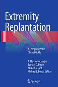 Extremity Replantation