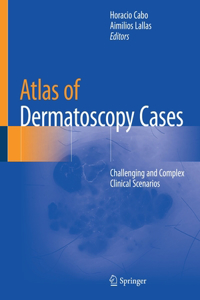 Atlas of Dermatoscopy Cases