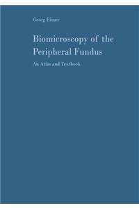 Biomicroscopy of the Peripheral Fundus