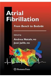 Atrial Fibrillation