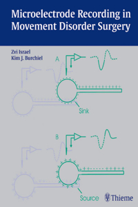 Microelectrode Recording in Movement Disorder Surgery
