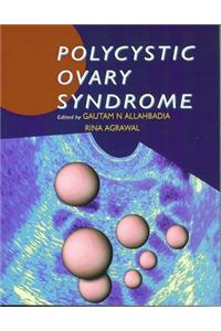 Polycystic Ovary Syndrome