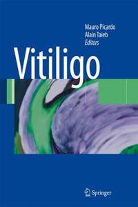 Vitiligo