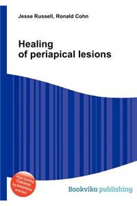 Healing of Periapical Lesions