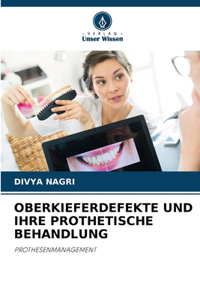 Oberkieferdefekte Und Ihre Prothetische Behandlung
