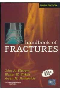 Handbook Of Fractures