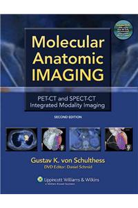 Molecular Anatomic Imaging: Pet-CT and Spect-CT Integrated Modality Imaging