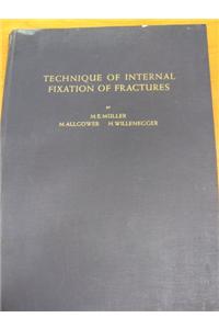 Technique of Internal Fixation of Fractures