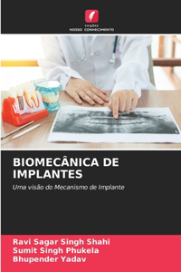 Biomecânica de Implantes
