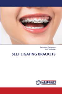 Self Ligating Brackets
