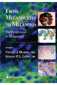 From Melanocytes to Melanoma