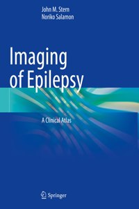 Imaging of Epilepsy