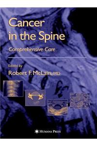 Cancer in the Spine