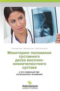 Monitoring Polozheniya Sustavnogo Diska Visochno-Nizhnechelyustnogo Sustava
