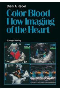 Color Blood Flow Imaging of the Heart