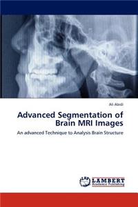 Advanced Segmentation of Brain MRI Images