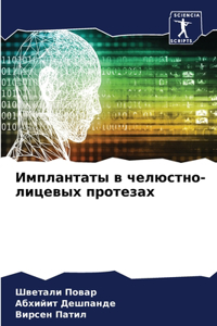 Имплантаты в челюстно-лицевых протезах